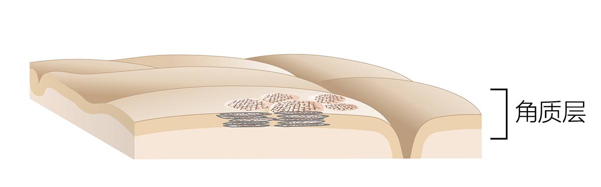角质层